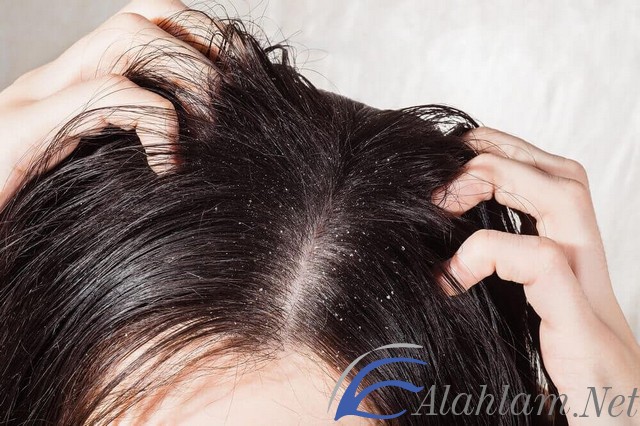 كيفية علاج حكة فروة الرأس بالخل