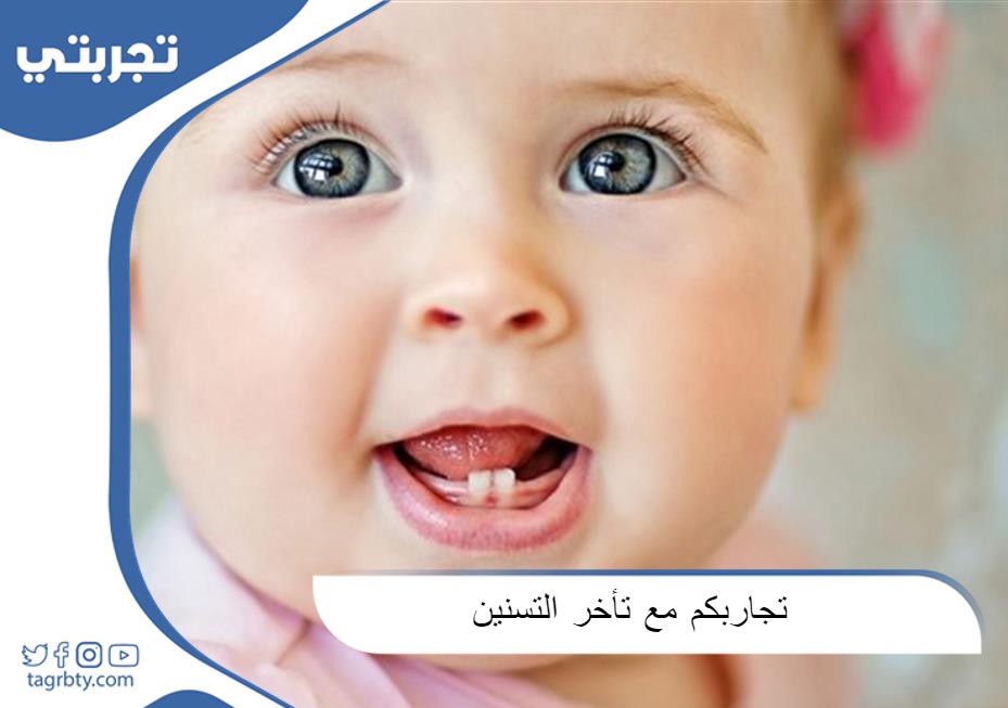 تجاربكم مع تأخر التسنين