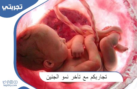 تجاربكم مع تأخر نمو الجنين