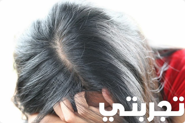 تجربتي مع الوسمة في القضاء على شيب الشعر
