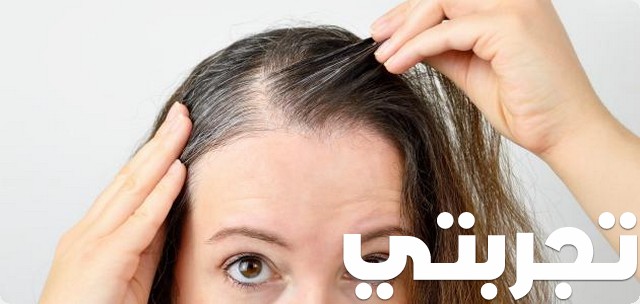 تجربتي مع بخاخ الشعر موستال