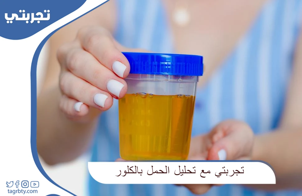 تجربتي مع تحليل الحمل بالكلور