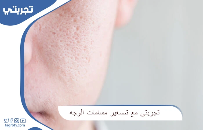 تجربتي مع تصغير مسامات الوجه