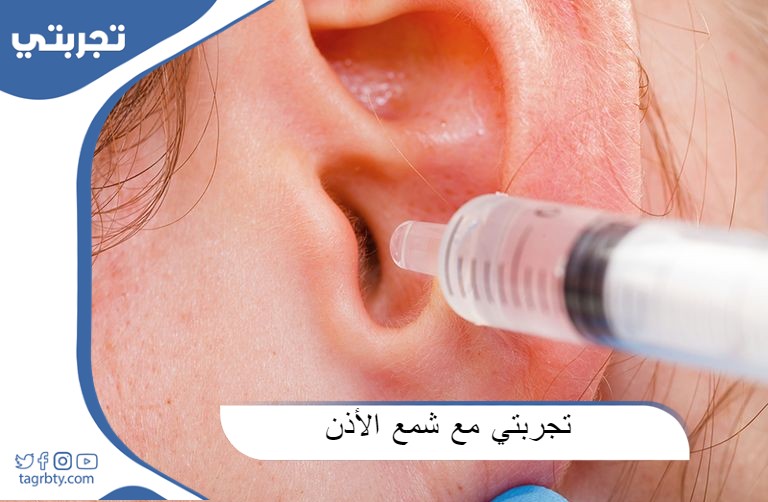 تجربتي مع شمع الأذن