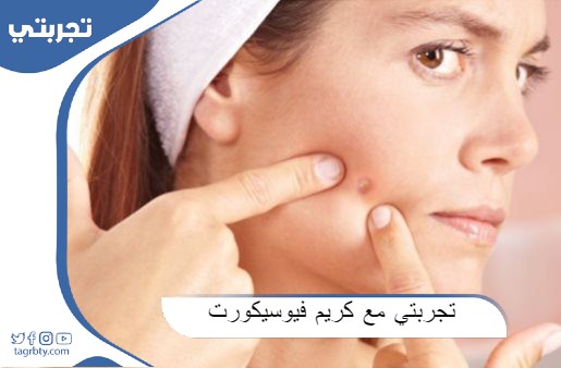 تجربتي مع كريم فيوسيكورت